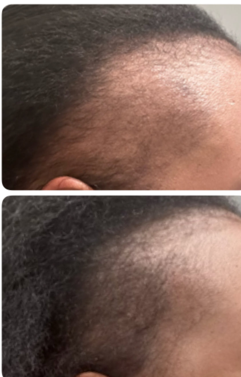Hair growth oil
