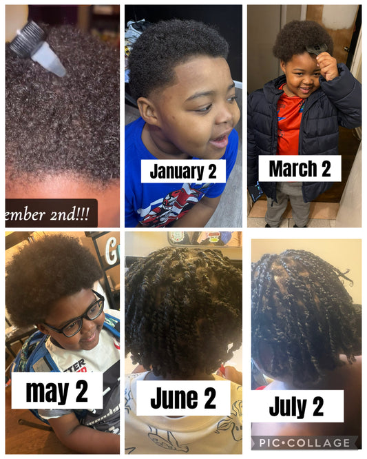 Hair growth oil